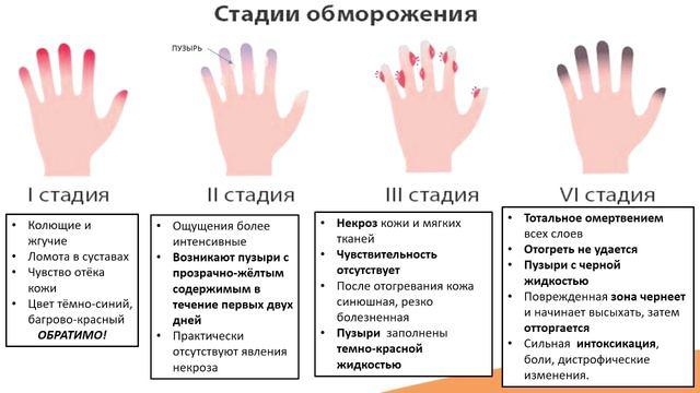 При любом термическом повреждении необходимо немедленно обращаться за квалифицированной медицинской помощью