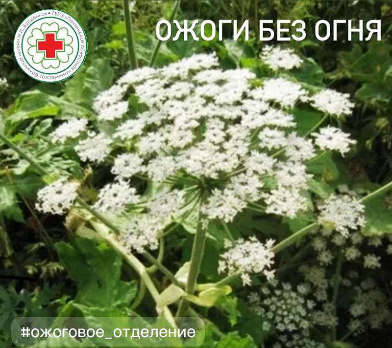 Ожоги без огня