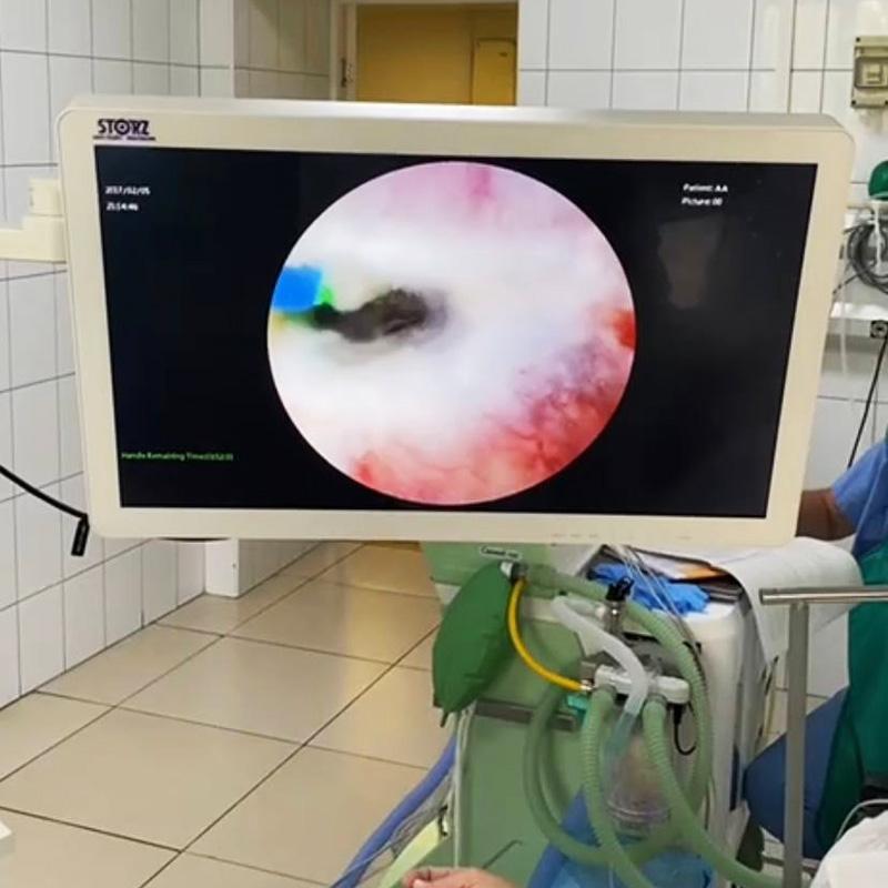 Впервые в регионе