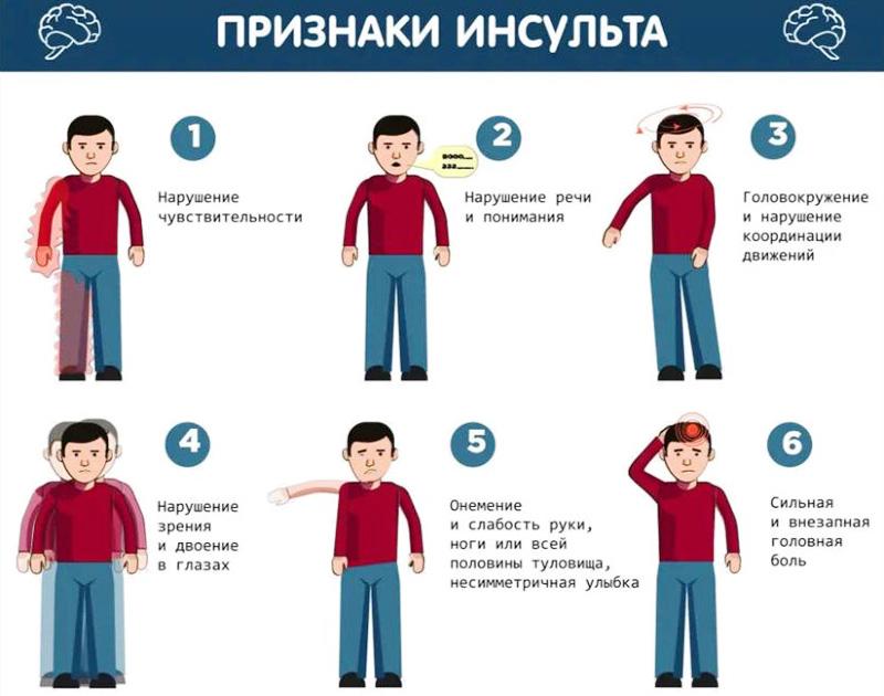 Золотой час Признаки инсульта
