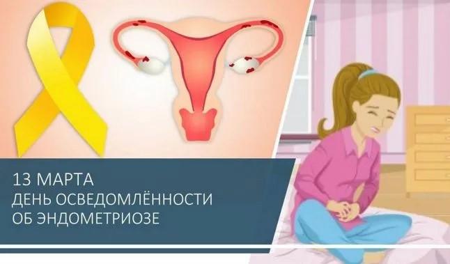 Эндометриоз, как причина бесплодия!